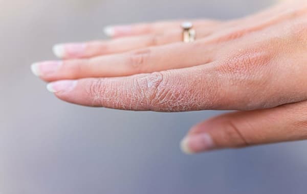 تصویر 2 از فروش کرم ترک دست و پا + قیمت خرید به صرفه